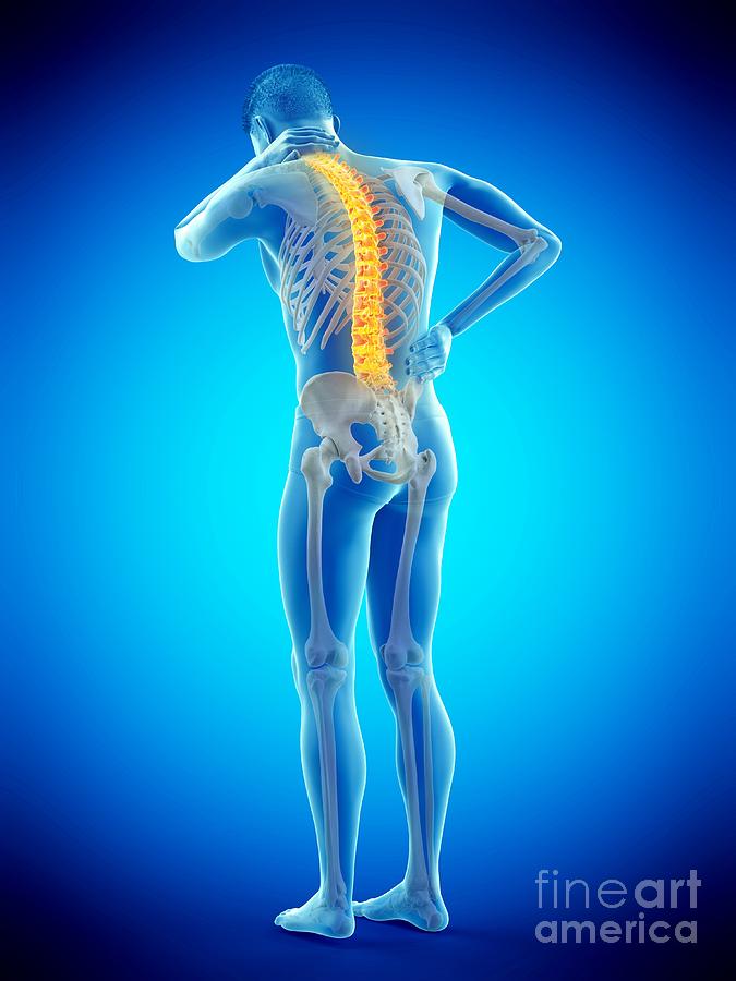 Skeleton Photograph - Back Pain #190 by Sebastian Kaulitzki/science Photo Library