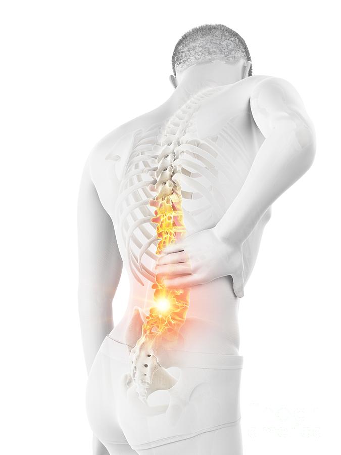 Skeleton Photograph - Back Pain #192 by Sebastian Kaulitzki/science Photo Library