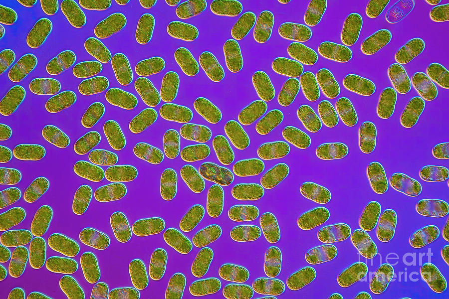 Actinotaenium Silvae-nigrae Cf. Algae #2 Photograph by Frank Fox/science Photo Library