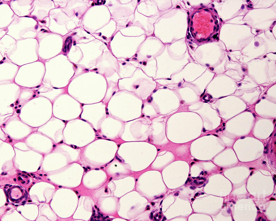 Adipose Tissue #2 Photograph by Jose Calvo / Science Photo Library