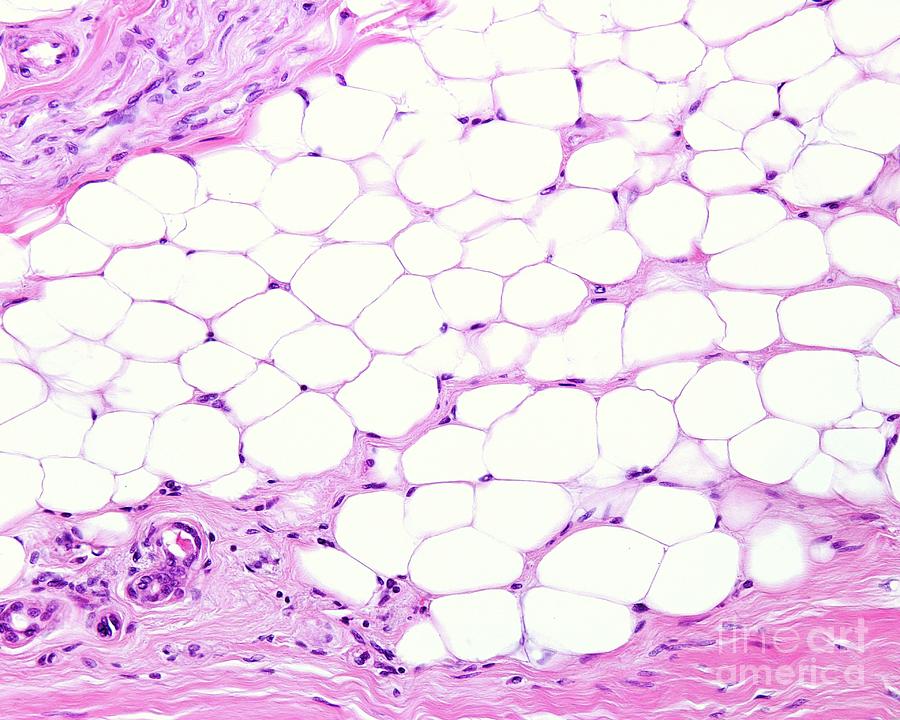 Adipose Tissue #2 Photograph by Jose Calvo/science Photo Library