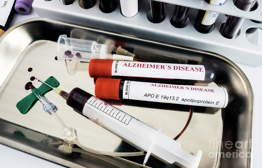 Alzheimers Disease Research #2 Photograph by Digicomphoto/science Photo Library