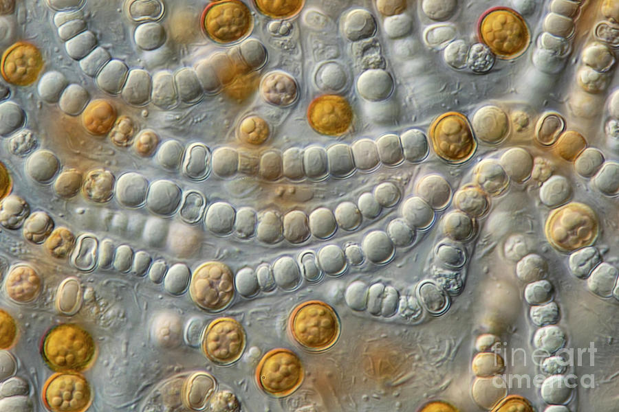 Anabaena Sp. Algae #2 Photograph by Frank Fox/science Photo Library