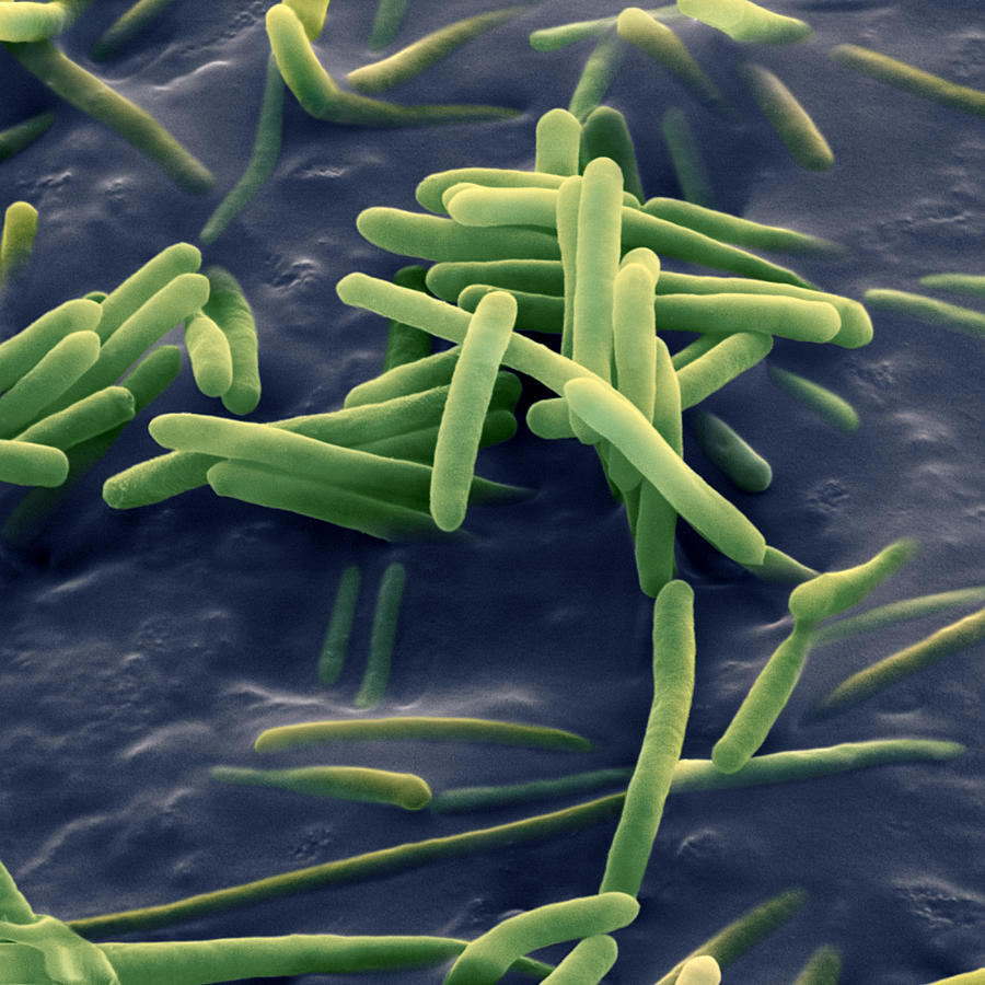 Bacillus Sphaericus Sem #2 Photograph by Meckes/ottawa