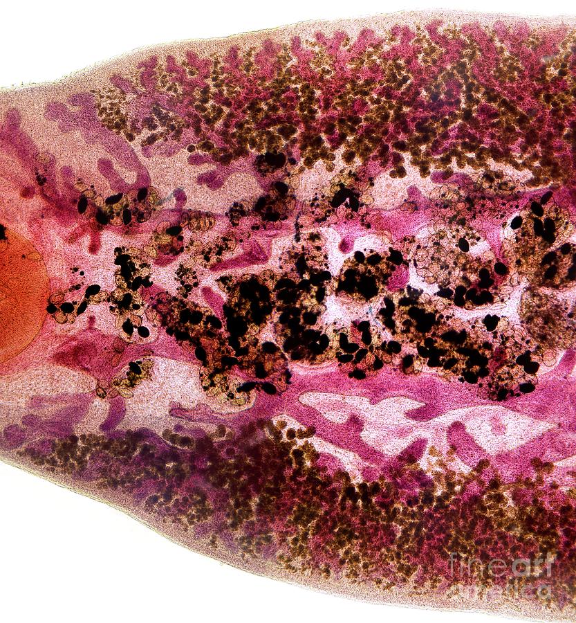 Nature Photograph - Beef Liver Fluke #2 by Dr Keith Wheeler/science Photo Library