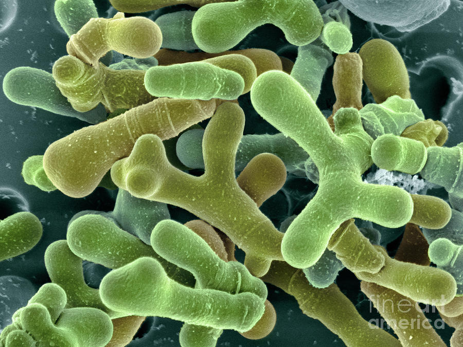 Bifidobacterium Animalis Bacteria #2 Photograph by Dennis Kunkel Microscopy/science Photo Library