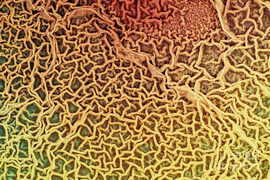 Biological Tissue Infected With Pathogenic Microorganisms #2 Photograph by Wladimir Bulgar/science Photo Library
