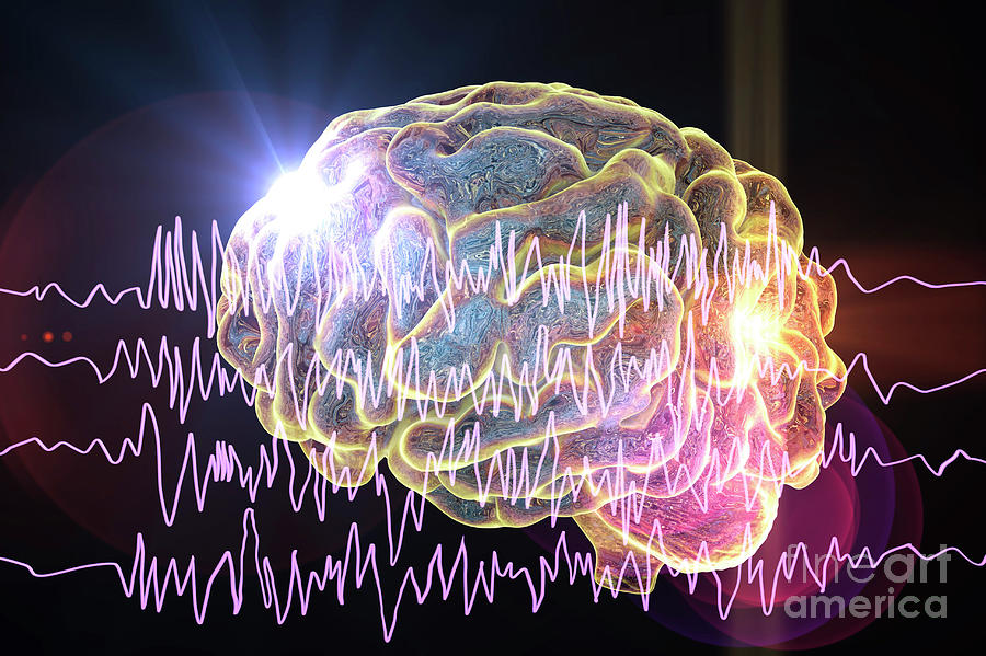 Brain And Brain Waves In Epilepsy Photograph By Kateryna Konscience Photo Library 7235