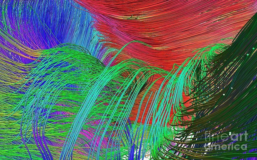 Brain Fibres From Fornix And Corpus Callosum Photograph by Do Tromp ...