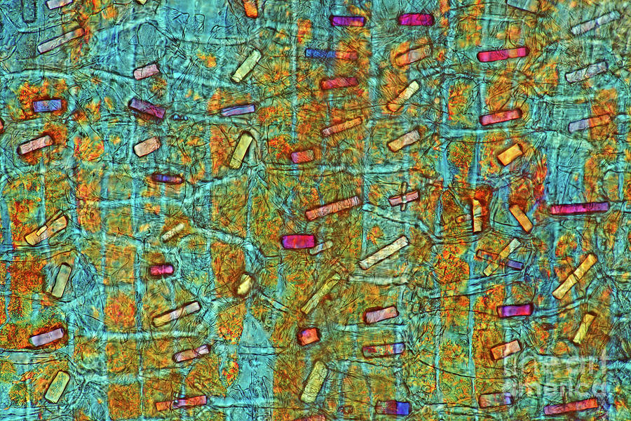 Calcium Oxalate Crystals In Onion Peel #2 Photograph by Marek Mis/science Photo Library