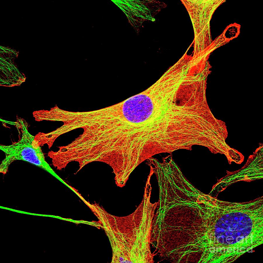 Cancer-associated Fibroblasts Photograph By David Robertson, Icr ...