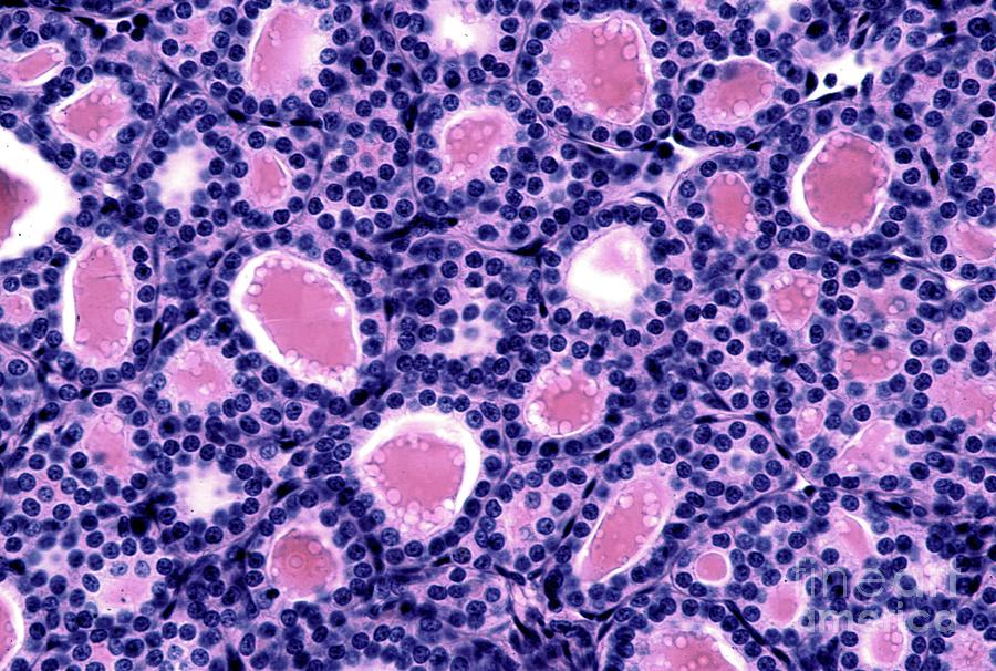 Cat Thyroid Gland Photograph by Jose Calvo / Science Photo Library Fine Art America