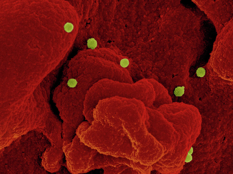 Cchf Virus, Sem #2 Photograph by Science Source