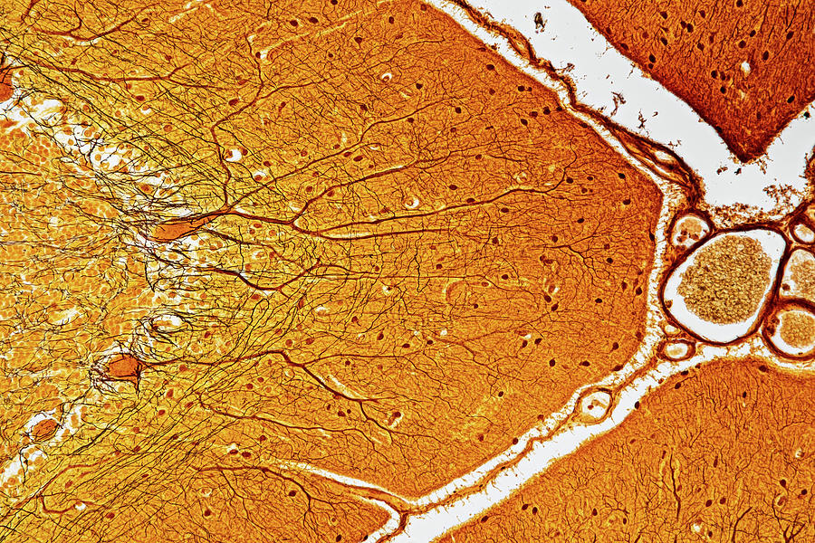 Cerebellum, Lm #2 Photograph by Oliver Meckes EYE OF SCIENCE