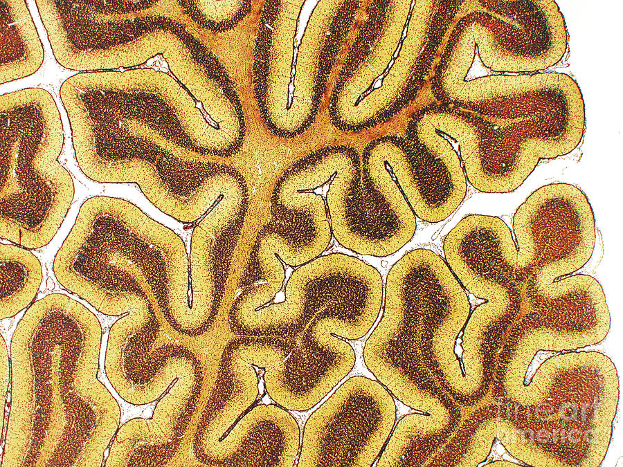 Cerebellum #2 Photograph by Microscape/science Photo Library