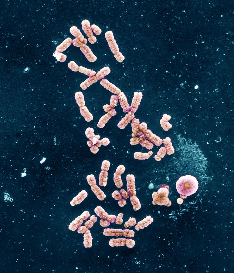 Chromosomes, Sem #2 Photograph by Biophoto Associates