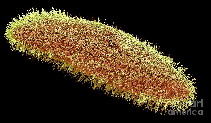 Ciliate Protozoan #2 Photograph by Steve Gschmeissner/science Photo Library