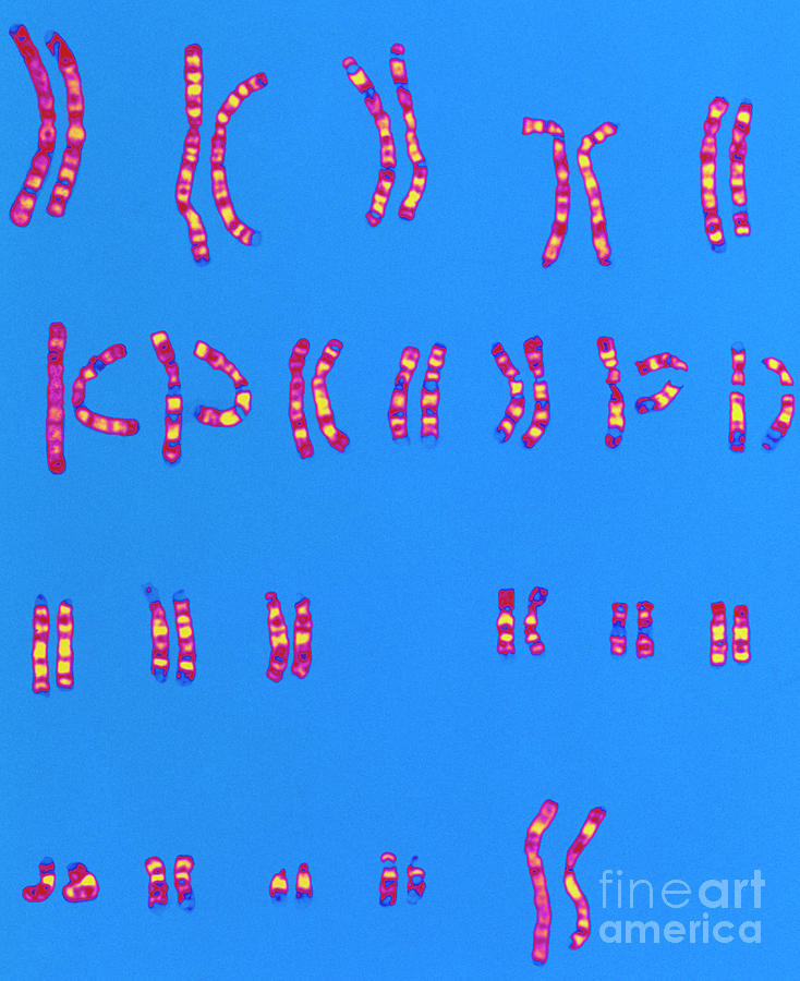 Coloured Lm Of A Normal Female Karyotype #2 Photograph by L. Willatt, East Anglian Regional Genetics Service/science Photo Library