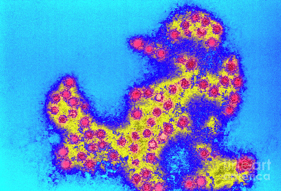Coloured Tem Of A Group Of Coxsackie Viruses 2 Photograph By Cdc Science Photo Library Pixels