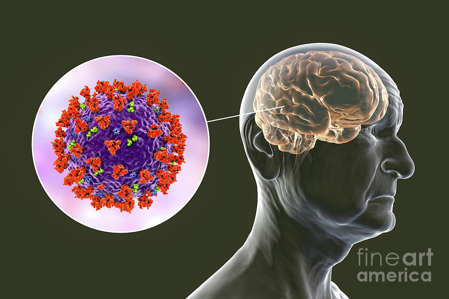 Covid-19 And Dementia Photograph By Kateryna Kon/science Photo Library ...