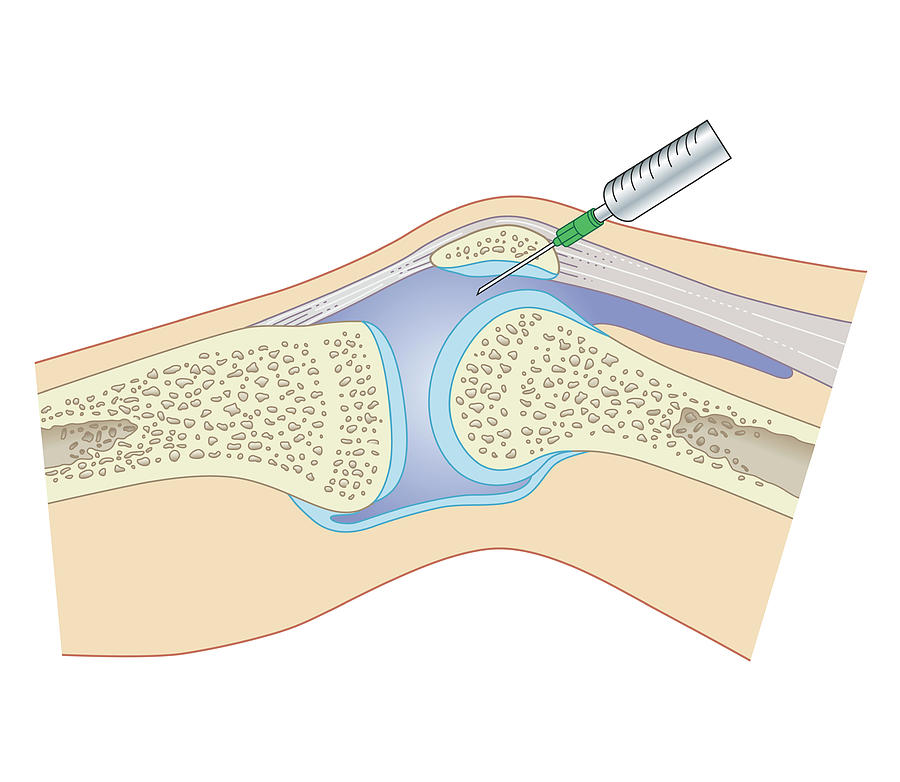 Cross Section Biomedical Illustration #2 Digital Art by Dorling Kindersley