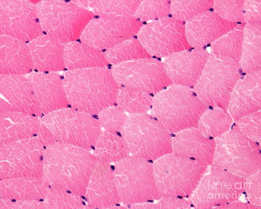 Cross-sectioned Skeletal Muscle Fibres #2 Photograph by Jose Calvo / Science Photo Library
