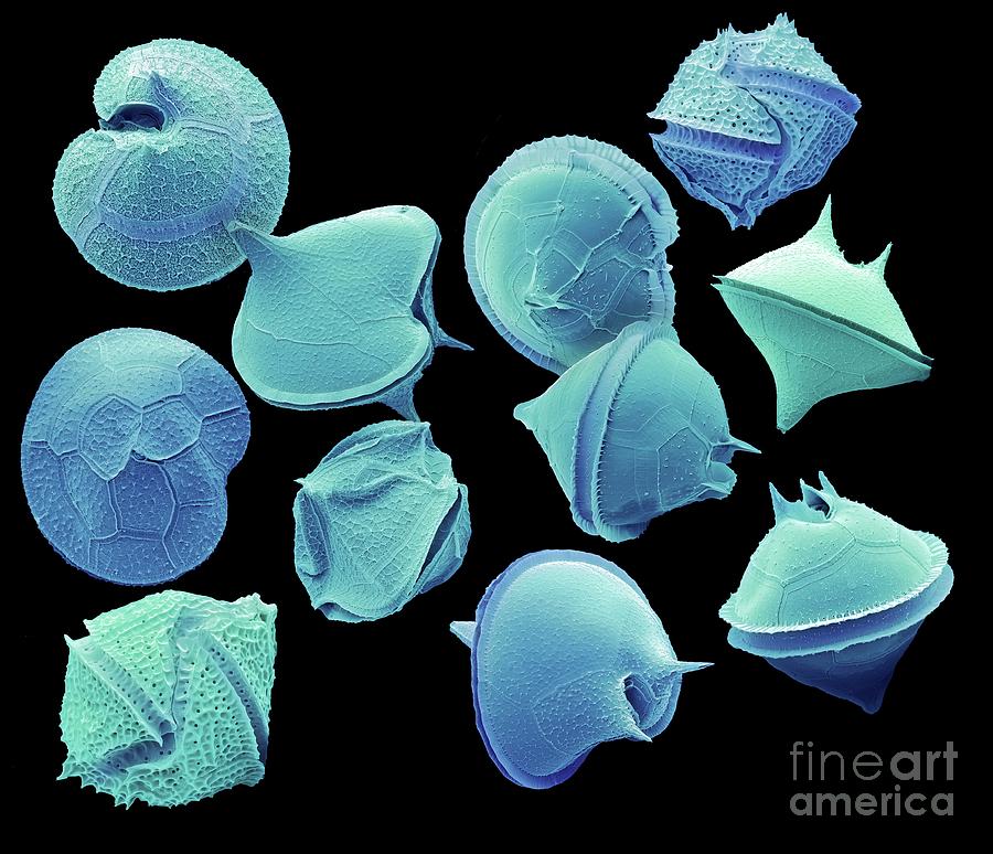 Wildlife Photograph - Dinoflagellate Protozoa #2 by Steve Gschmeissner/science Photo Library