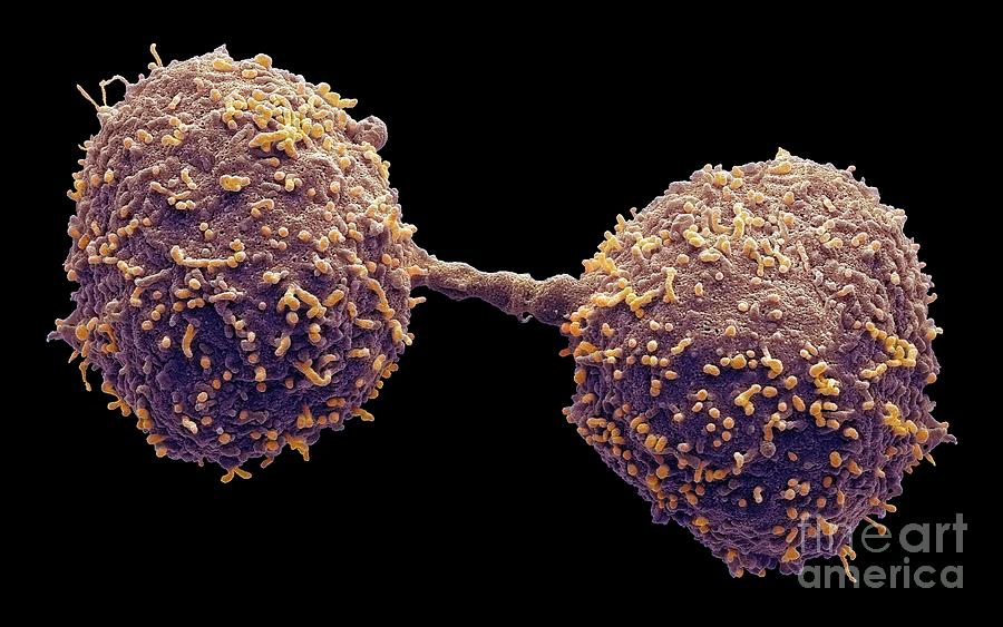 Dividing Prostate Cancer Cells Photograph by Steve Gschmeissner/science ...