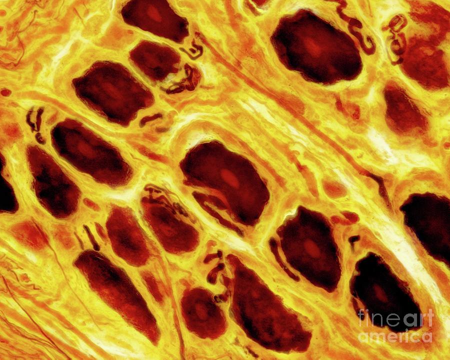 Dorsal Root Ganglion #2 Photograph by Jose Calvo / Science Photo Library