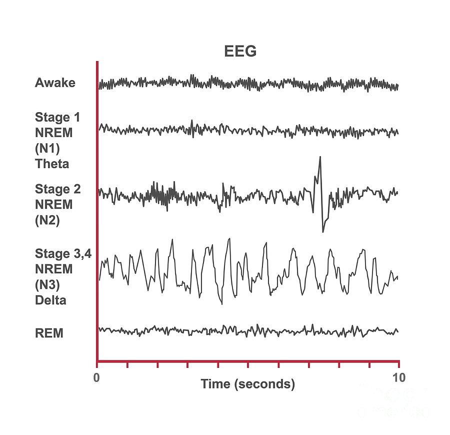 Eeg Sleep Stages #2 Photograph by Cordelia Molloy/science Photo Library