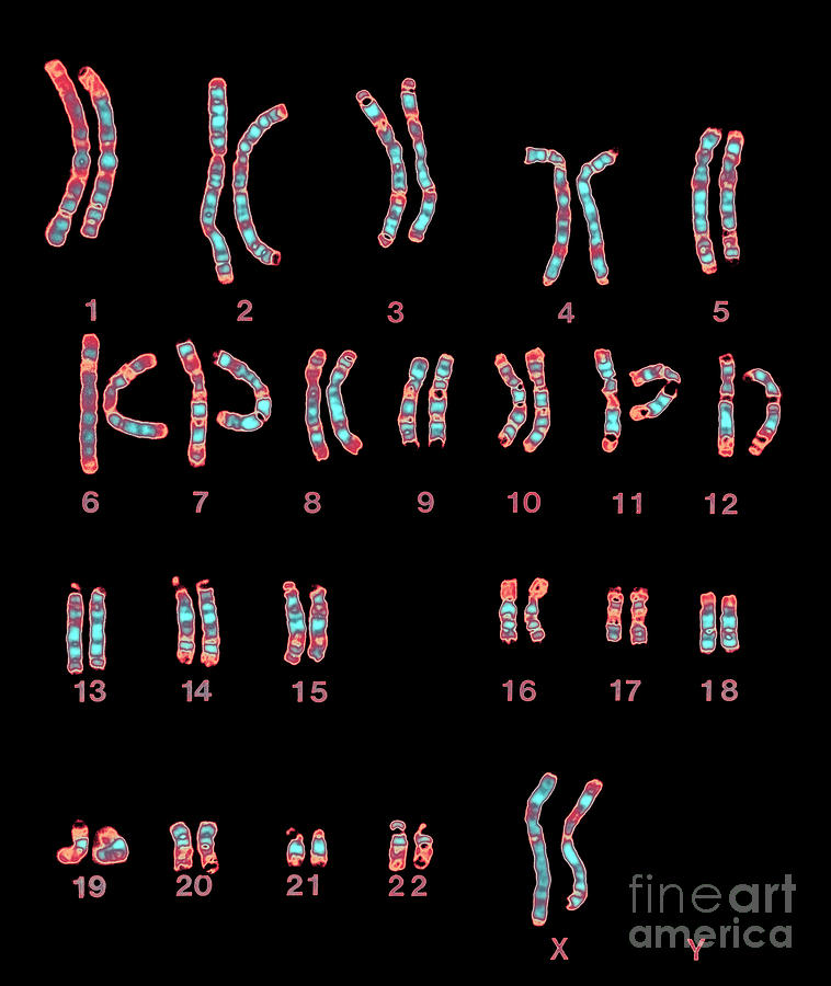 Enhanced Lm Of Normal Female Chromosomes Photograph By Dept Of Clinical Cytogenetics 