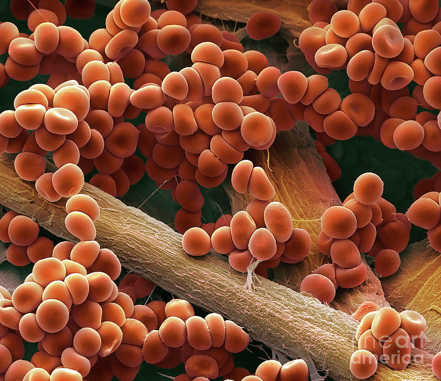 enlarged-red-blood-cells-photograph-by-steve-gschmeissner-science-photo