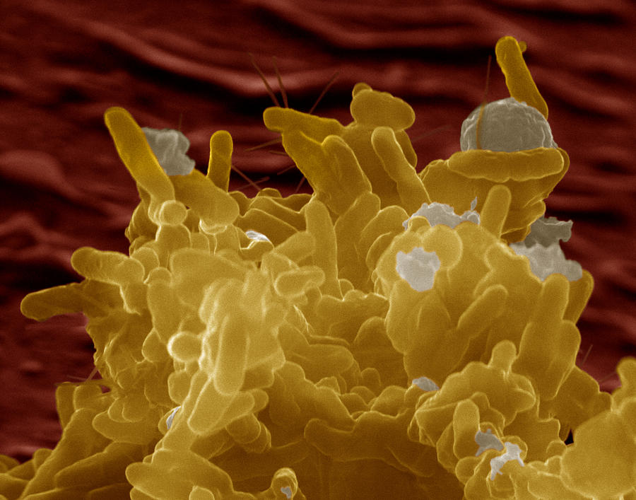 Enterobacter Cloacae #2 Photograph by Meckes/ottawa