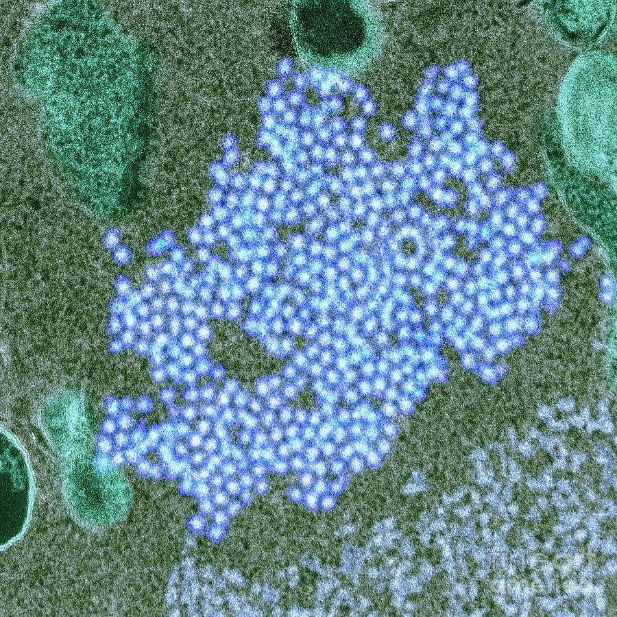 Virus Photograph - Enterovirus 68 Virions #2 by Cdc/science Photo Library
