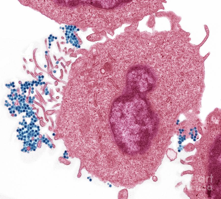 Epstein Barr Virus Photograph by Steve Gschmeissner/science Photo