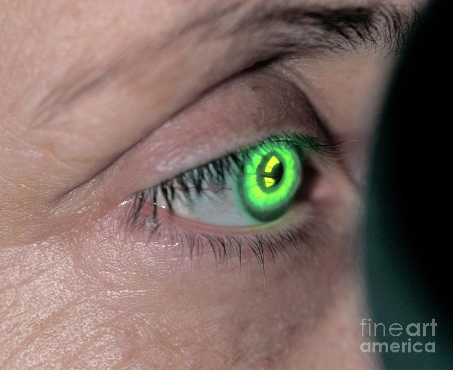 Eye Examination #2 Photograph by Pascal Goetgheluck/science Photo Library