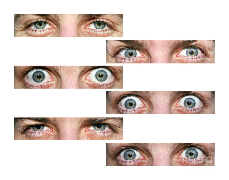 Eye Expressions #2 Photograph by Cordelia Molloy/science Photo Library