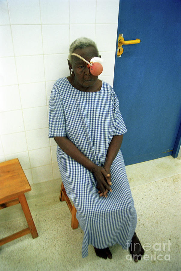 Eye Surgery Patient #2 Photograph by Jason Kelvin/science Photo Library