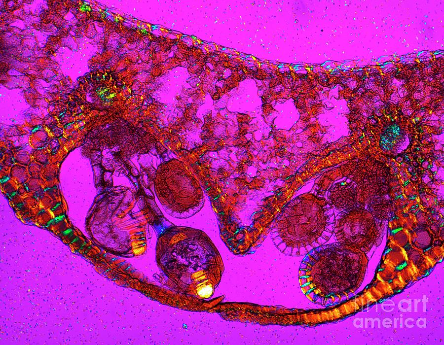 Fern Spore Capsule #2 Photograph by Dr Keith Wheeler/science Photo Library
