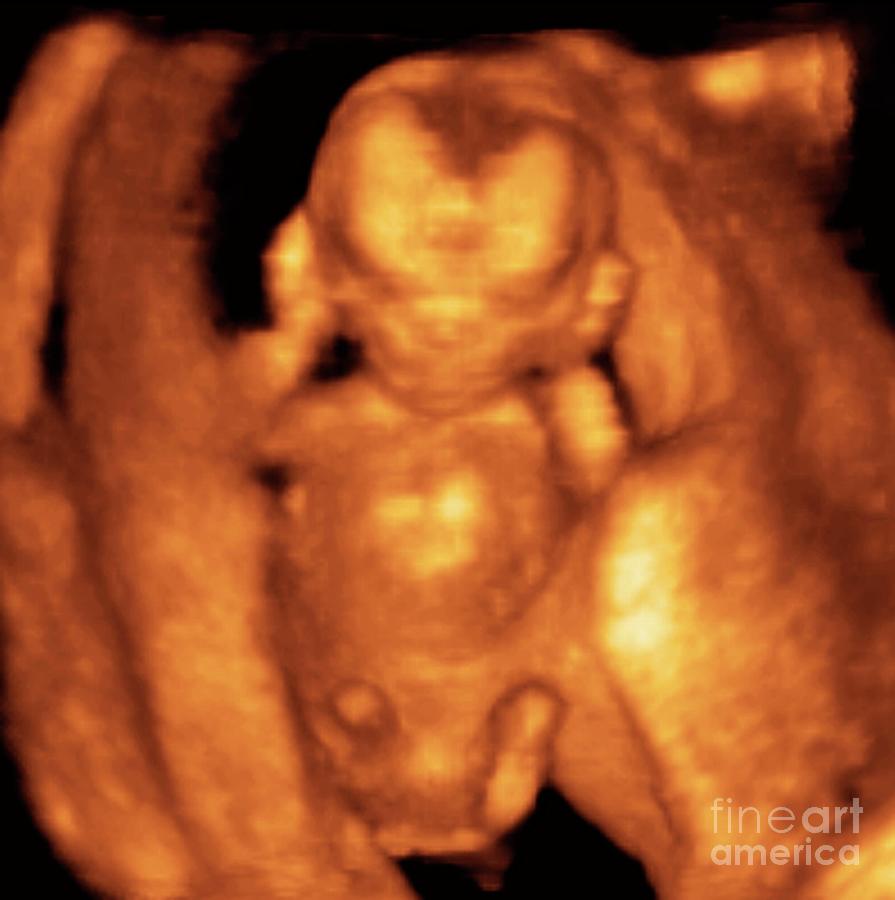 Foetus At 12 Weeks Photograph by Dr Najeeb Layyous/science Photo ...