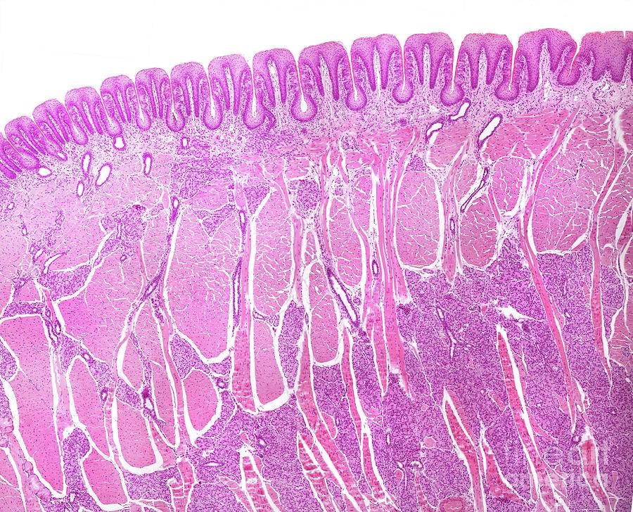 Foliate Papillae With Taste Buds #2 Photograph by Jose Calvo / Science Photo Library