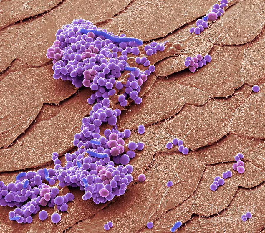 Staphylococcus Epidermidis Bacteria by Steve Gschmeissner