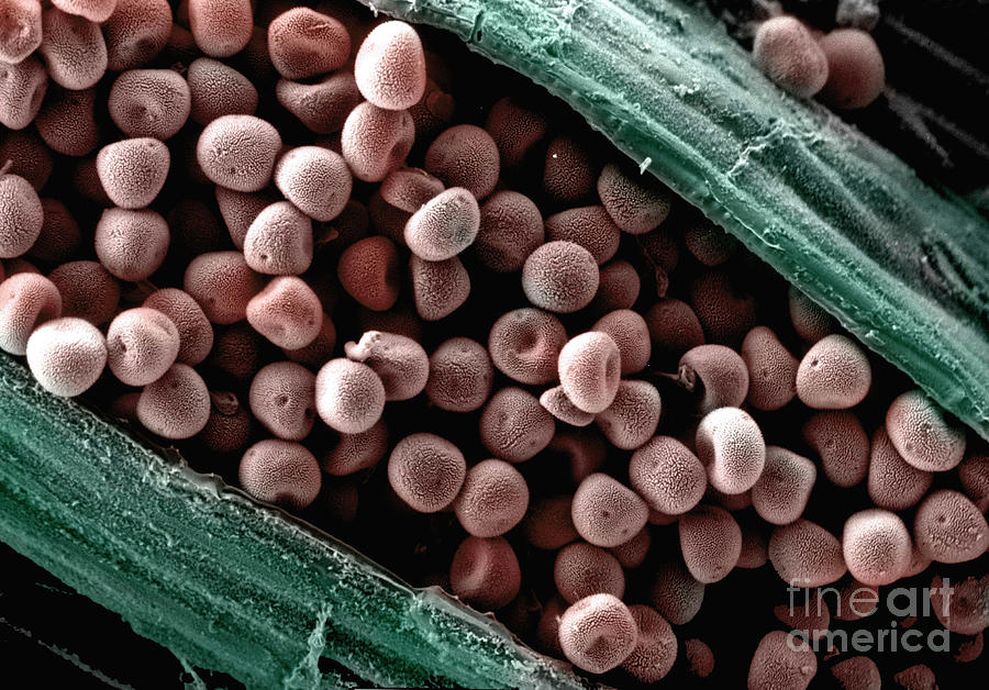 Fungal Spores #2 Photograph by Dr Philippa Uwins, Whistler Research Pty/science Photo Library