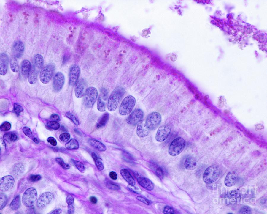 Gallbladder Epithelium Photograph by Jose Calvo / Science Photo Library ...