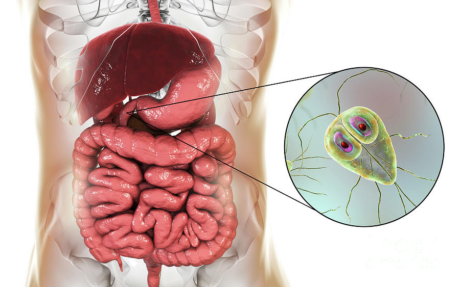 Giardia Lamblia In Human Duodenum Photograph By Kateryna Konscience Photo Library Pixels 4258