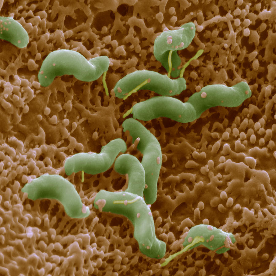 Helicobacter Pylori #2 Photograph by Eye Of Science