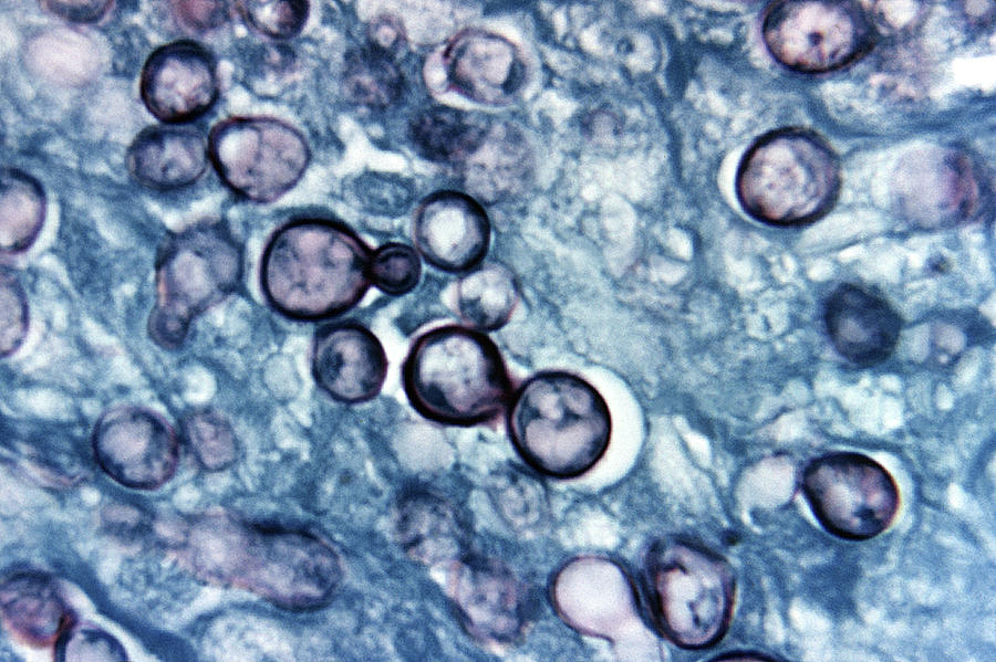 Histoplasma Capsulatum, Histoplasmosis #2 Photograph by Science Source