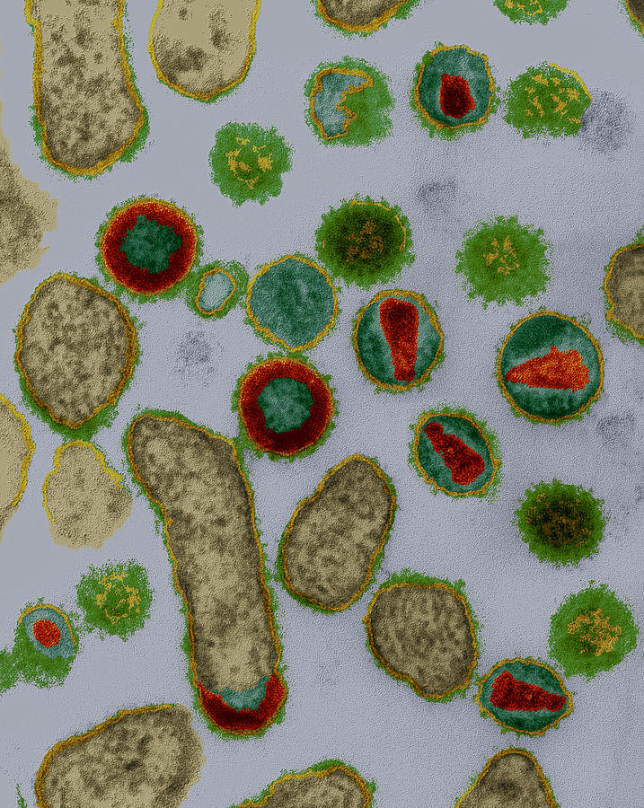 Hiv Viruses #2 Photograph by Meckes/ottawa