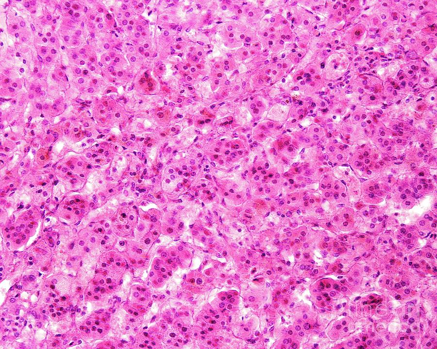 Human Adrenal Cortex Photograph by Jose Calvo / Science Photo Library