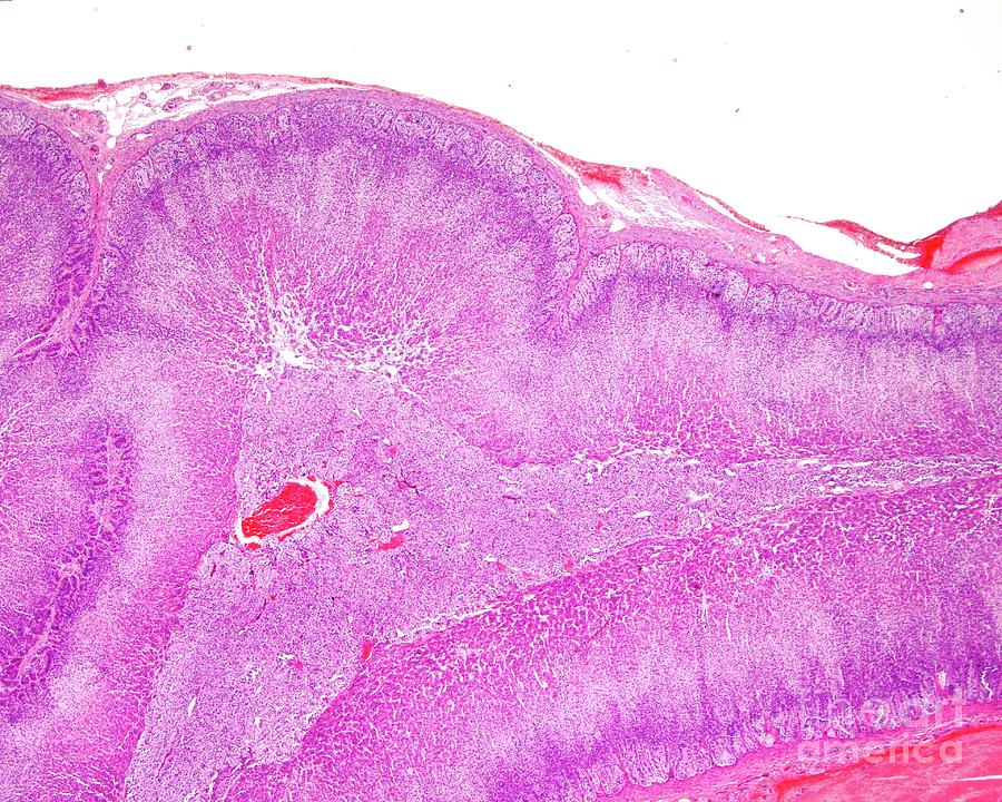 Human Adrenal Gland Cortex And Medulla Photograph By Jose Calvo